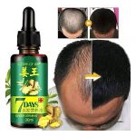 Alikay Naturals Essential 17 Hair Growth Oil