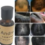 Andrea hair growth essence