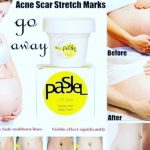 Pasjel Stretch Marks Cream