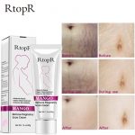 RtopR  Remove Pregnancy Scars/Stretch Marks Cream