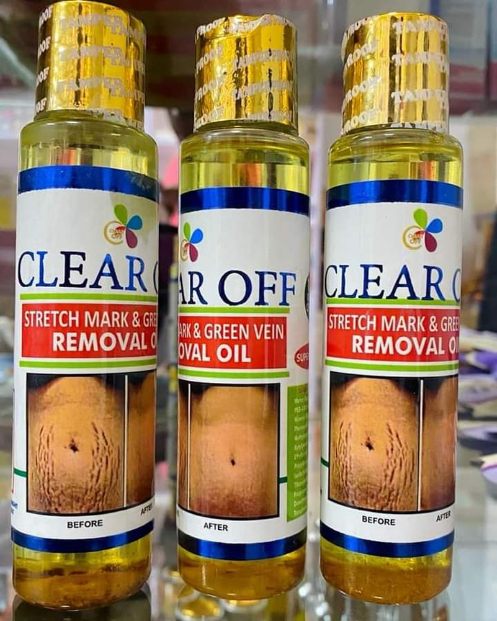 Stretch Mark And Green Vein Removal Oil