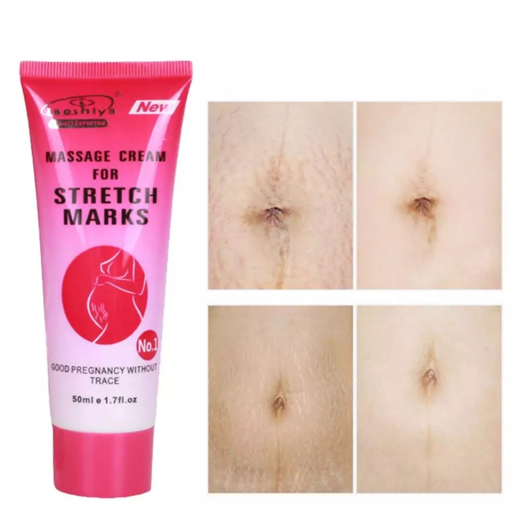 where to buy stretch marks cream in ghana