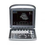 Chilson ECO1 Ultrasound Scan