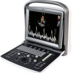 Ultrasound Machine (Chison ECO 6 expert with two probes)