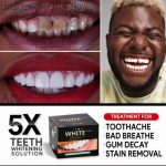5X Teeth Whitening Solution