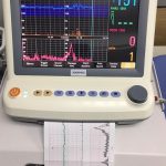 Cardiotocography Machine (CTG)