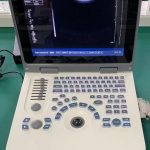 Sonotech 3D Ultrasounds With Convex Probes And Printer