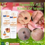 Anti Warts Cream