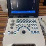 Portable Ultrasound Scan Machine With A Curvilinear Probe